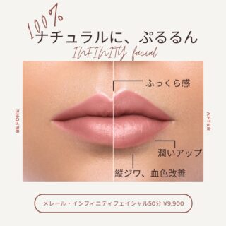 ・
・
 『エンダモロジー』は、世界100カ国以上で毎日30万人以上女性が受けているトリートメント。
35年以上続いてきたフランスの美容技術✨
・
その最新機種、インフィニティのフェイシャルは
100％ナチュラルな方法で唇👄や、まぶた👁️にも
アプローチできます✨

より深く、より強力な施術で
表層から深層まで肌の状態を整えて
健康でハリのある状態に導きます。
・
革新的な3 0 H z のバイブレーションと
電動フラップの動き、さらに連続吸引を組み合わせた
新しい技術で、肌の弾力性やハリを回復し
肌内部から本格的なエイジングケアを実現します。
ユニークで強い体感のある多次元的な刺激を与えながら
さらにリラックス効果をもたらします♡
・
・
お身体もおすすめですが、隠れファンが多いエンダモロジー
インフィニティフェイシャルもぜひ♡
今なら体験1回¥9,900
・
・
#merelle #ginza #infinity  #endermologie 
#france🇫🇷